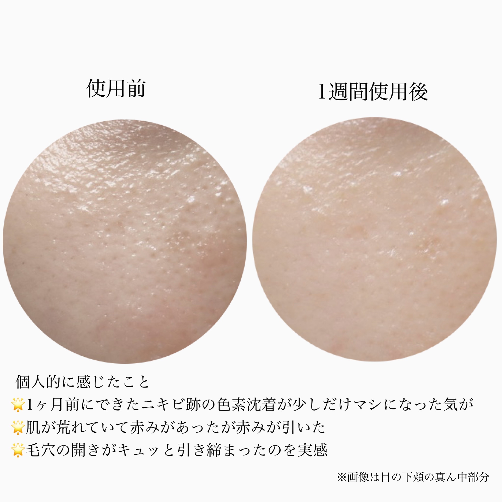 を使ったクチコミ（3枚目）