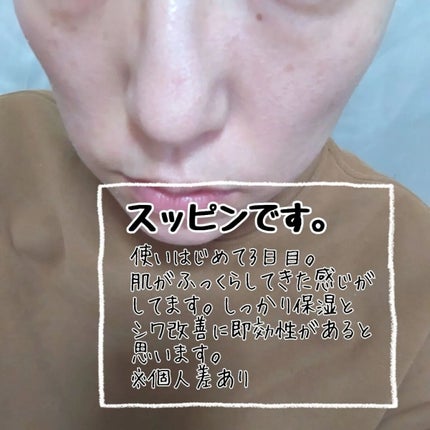 レチノール0.1%クリーム/Frankly/フェイスクリームを使ったクチコミ(3枚目)