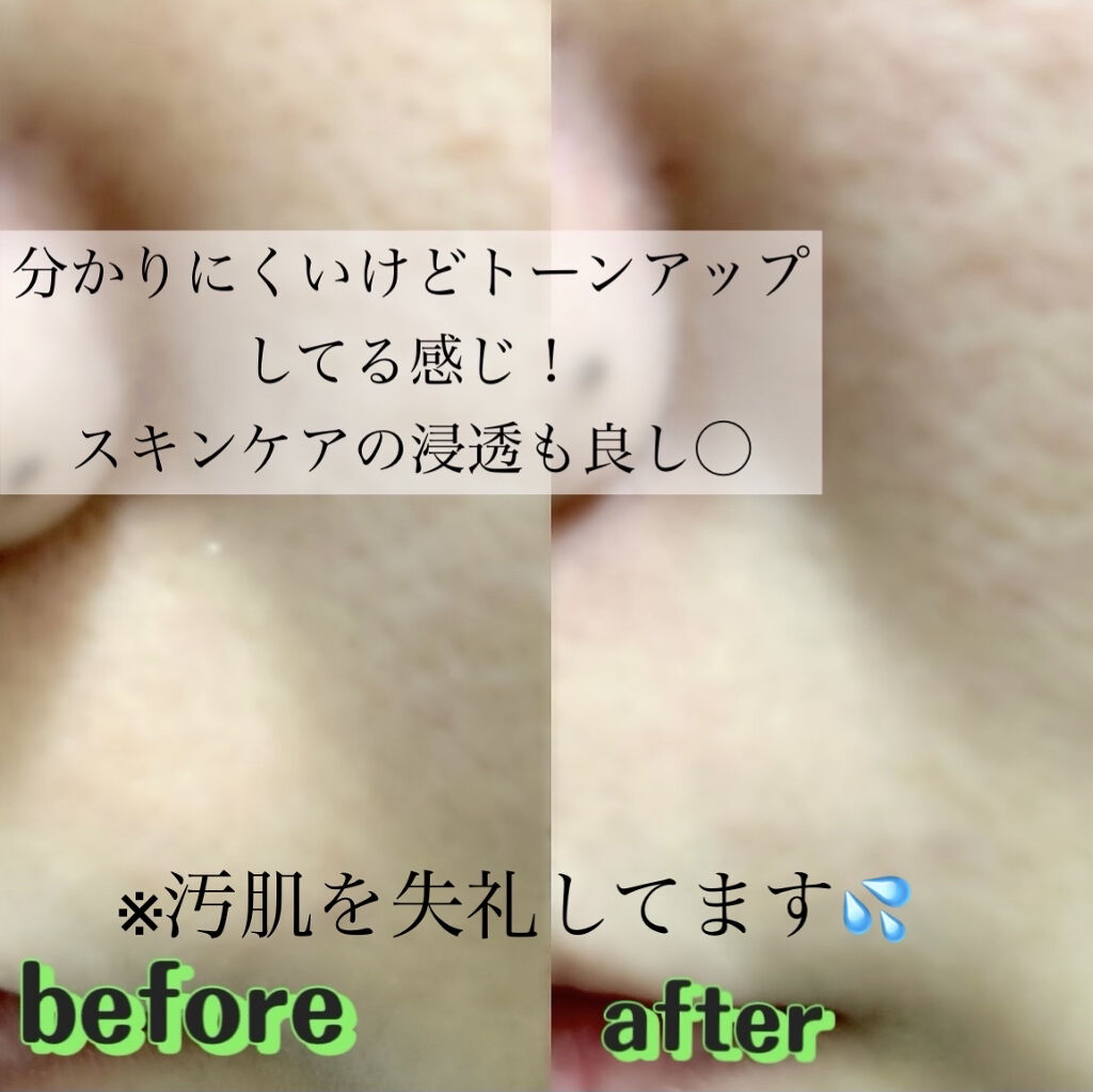 Le ment モイスチャーピーリングプロのクチコミ「\自宅でサロン級ケア/


これ1台で3つのサロン級ケア✦ฺ


♥︎Le ment（#ルメン.....」（3枚目）