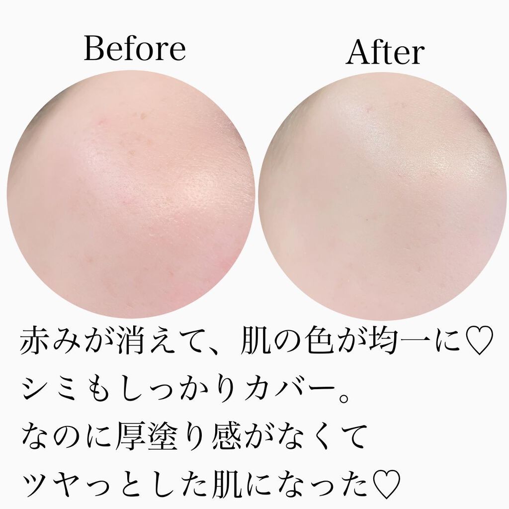 ディロングBBクリーム/RENODERM/BBクリームを使ったクチコミ（2枚目）