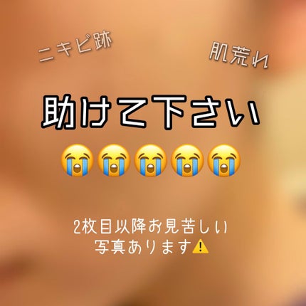 ハトムギ化粧水(ナチュリエ スキンコンディショナー R )/ナチュリエ/化粧水を使ったクチコミ(1枚目)