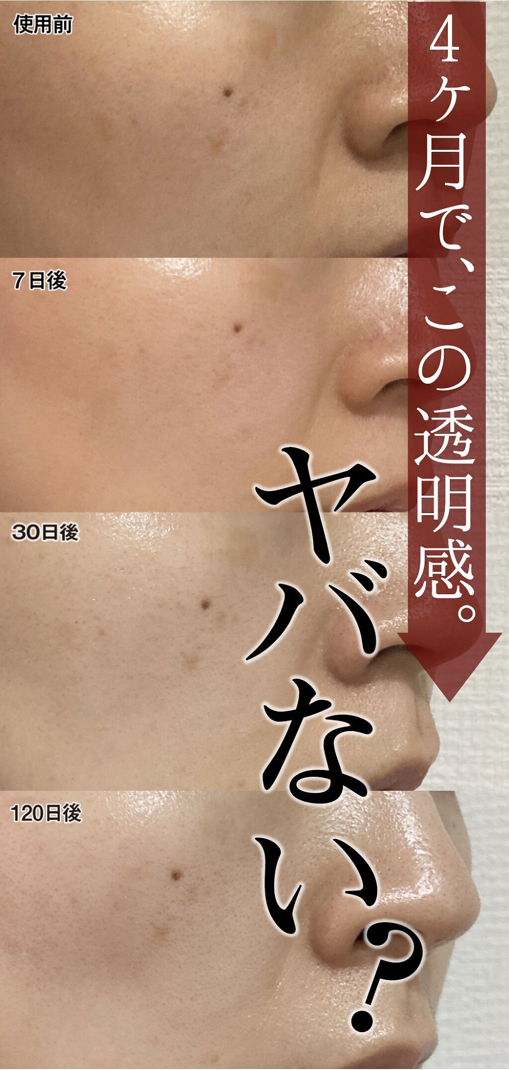 Melano Hunt/fibonacci/化粧水を使ったクチコミ（1枚目）