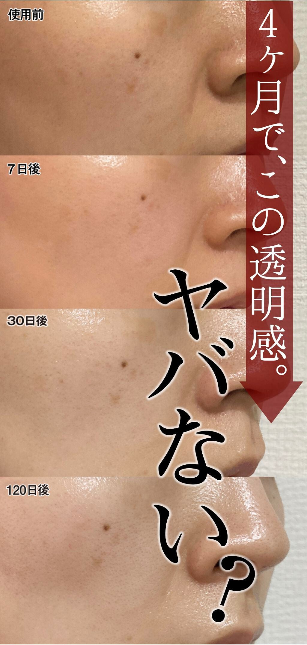 Melano Hunt/fibonacci/化粧水を使ったクチコミ(1枚目)