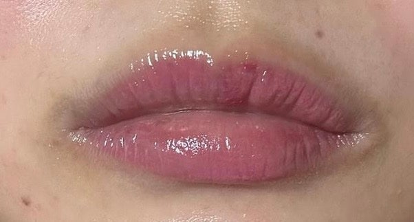 cst on LIPS 「#LIP#Before#After..」(2枚目)