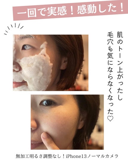 スパークリングセラムパック【YELLOW】/AKAHA/シートマスク・パックを使ったクチコミ(6枚目)