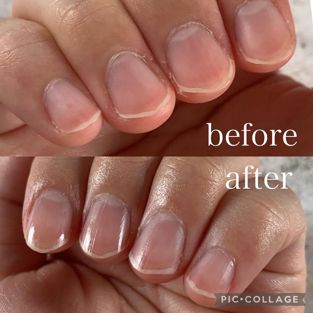 スチーマー ナノケア EH-SA64 -P(ピンク調)/Panasonic/美顔器・マッサージを使ったクチコミ（3枚目）