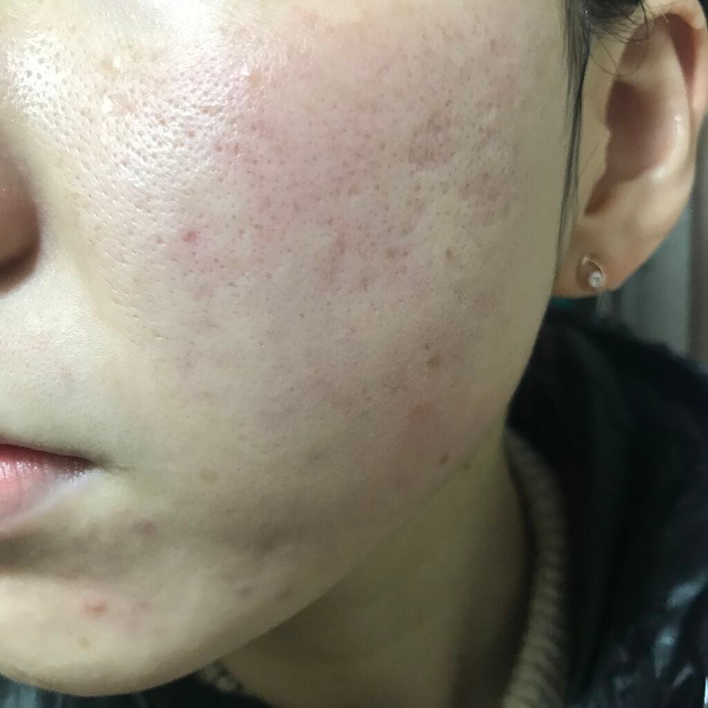 シルコット うるうるコットン/シルコット/コットンを使ったクチコミ(2枚目)