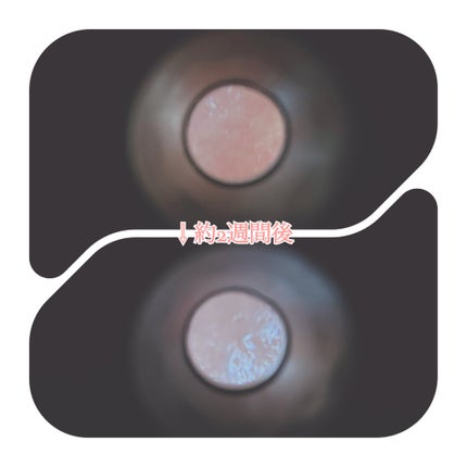 プロCICAリードルショット100/VT/ブースター・導入液を使ったクチコミ(6枚目)