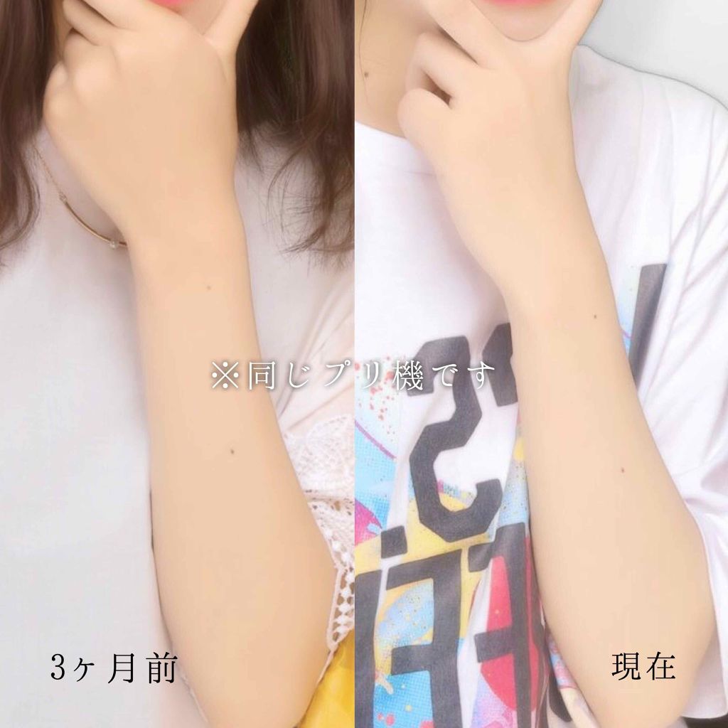 ハトムギ化粧水(ナチュリエ スキンコンディショナー R )/ナチュリエ/化粧水を使ったクチコミ(2枚目)