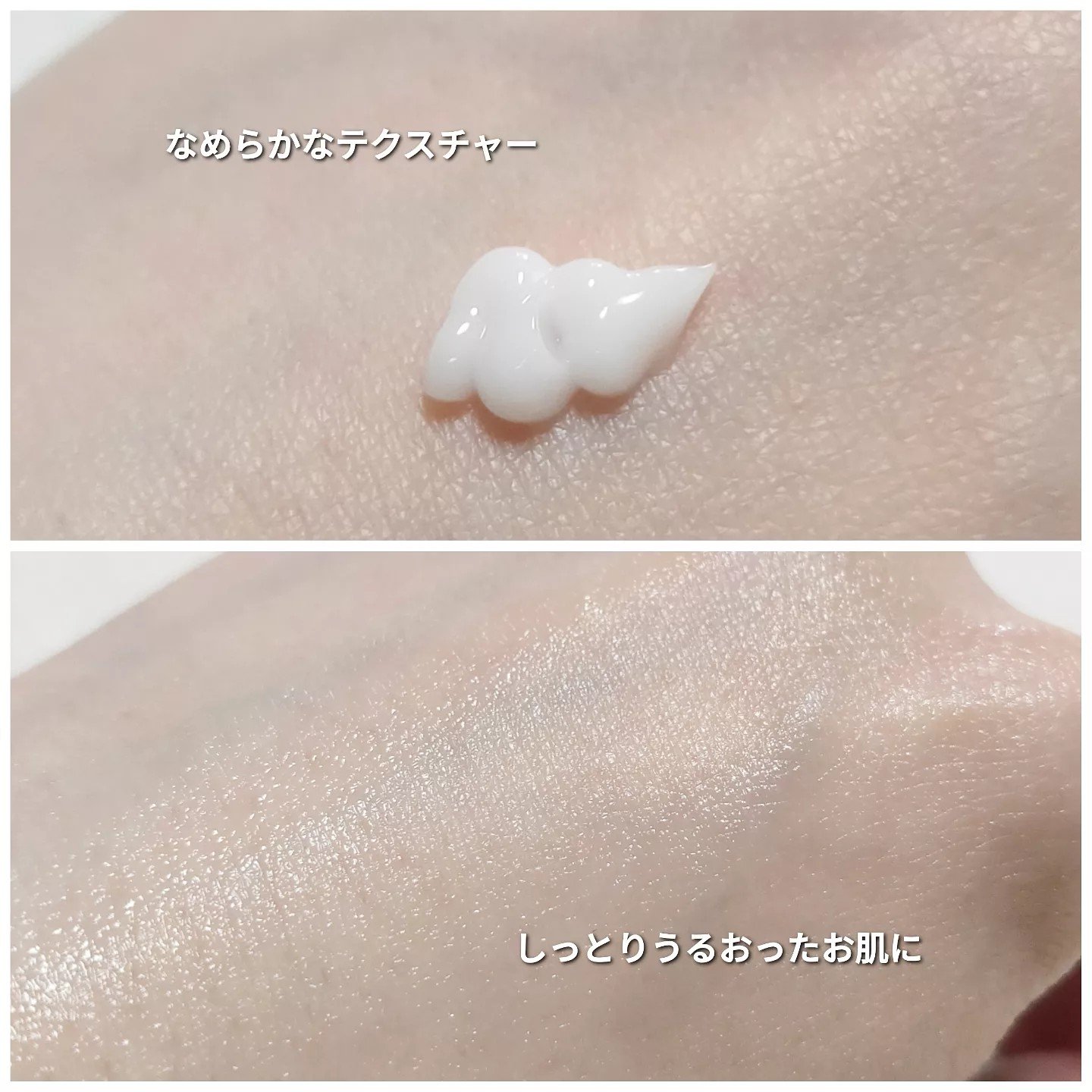 サミュ PHセンシティブフェイシャルトリートメント/SAM'U/美容液を使ったクチコミ（3枚目）