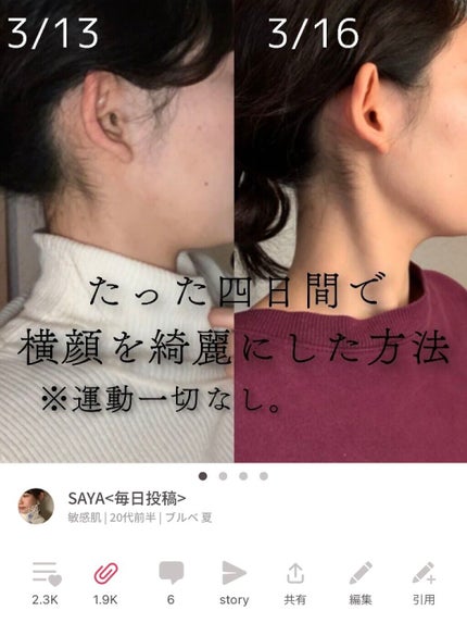 小顔美顔器/ASDSH/美顔器・マッサージを使ったクチコミ(1枚目)