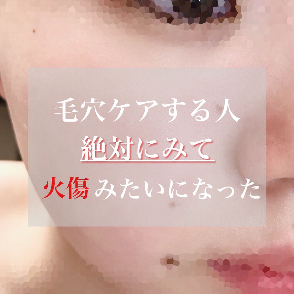 オバジC 酵素洗顔パウダー/オバジ/洗顔パウダーを使ったクチコミ（1枚目）