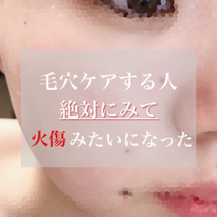オバジC 酵素洗顔パウダー/オバジ/洗顔パウダーを使ったクチコミ(1枚目)