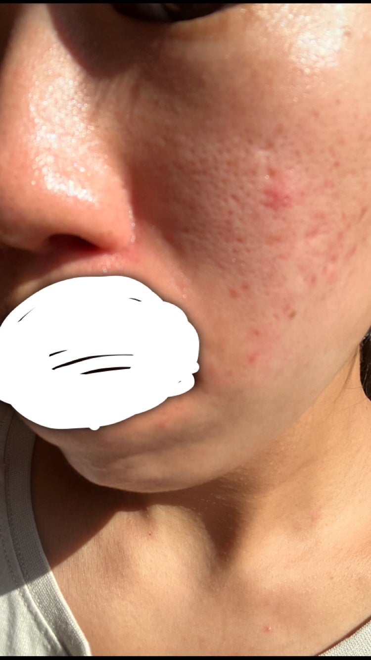 ðªððŽð²ð on LIPS ã1æ¥ã«äœåæçš¿ããããã£ãŠæãããã©ãã¡ãã§ã12æ27æ¥æ¬æ¥..ãïŒ2æç®ïŒ