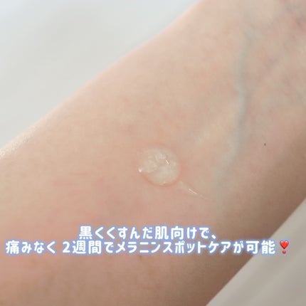 5GF リフティナル ターンオーバー 美容液/Mildlab/美容液を使ったクチコミ(3枚目)