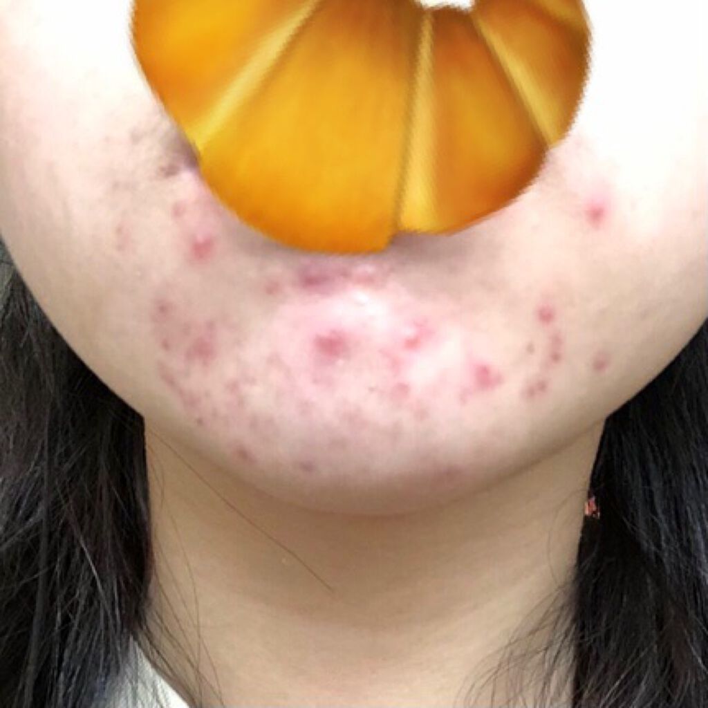 化粧水・敏感肌用・高保湿タイプ/無印良品/化粧水を使ったクチコミ(3枚目)