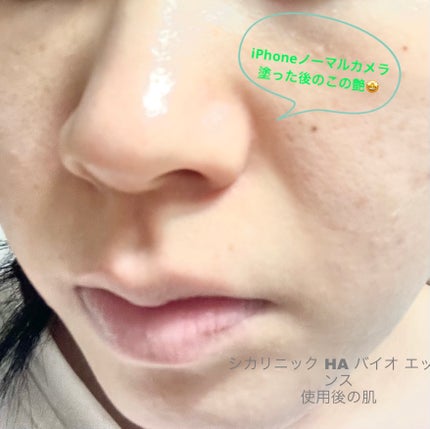 シカリニック HA バイオ エッセンス/CICALINIC/美容液を使ったクチコミ(3枚目)