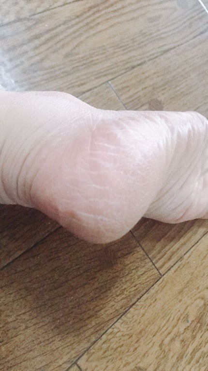 イージーパックDP60分タイプ/ベビーフット/レッグ・フットケアを使ったクチコミ(5枚目)