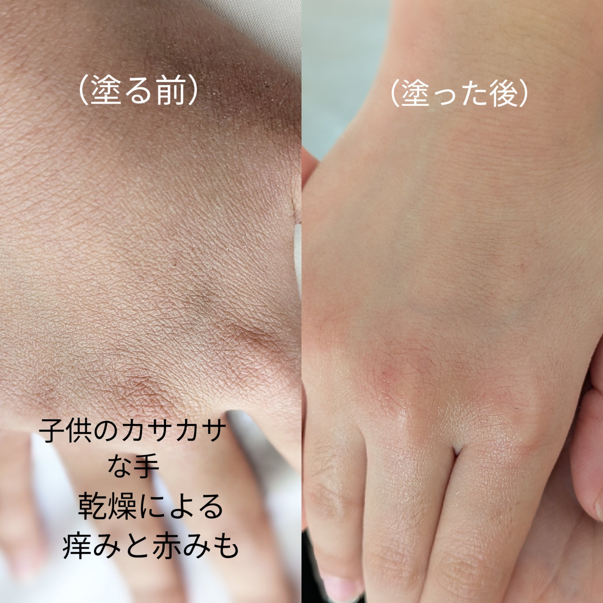 ザモイスチャーバリアDマルチバーム/Dr.G/フェイスバームを使ったクチコミ（3枚目）