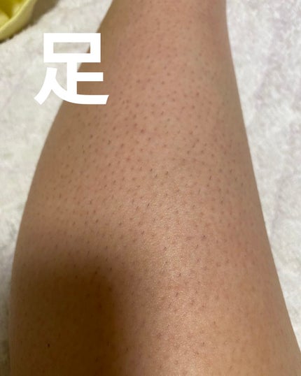 FASIZ607C IPL光脱毛器/FASIZ/家庭用脱毛器を使ったクチコミ(2枚目)