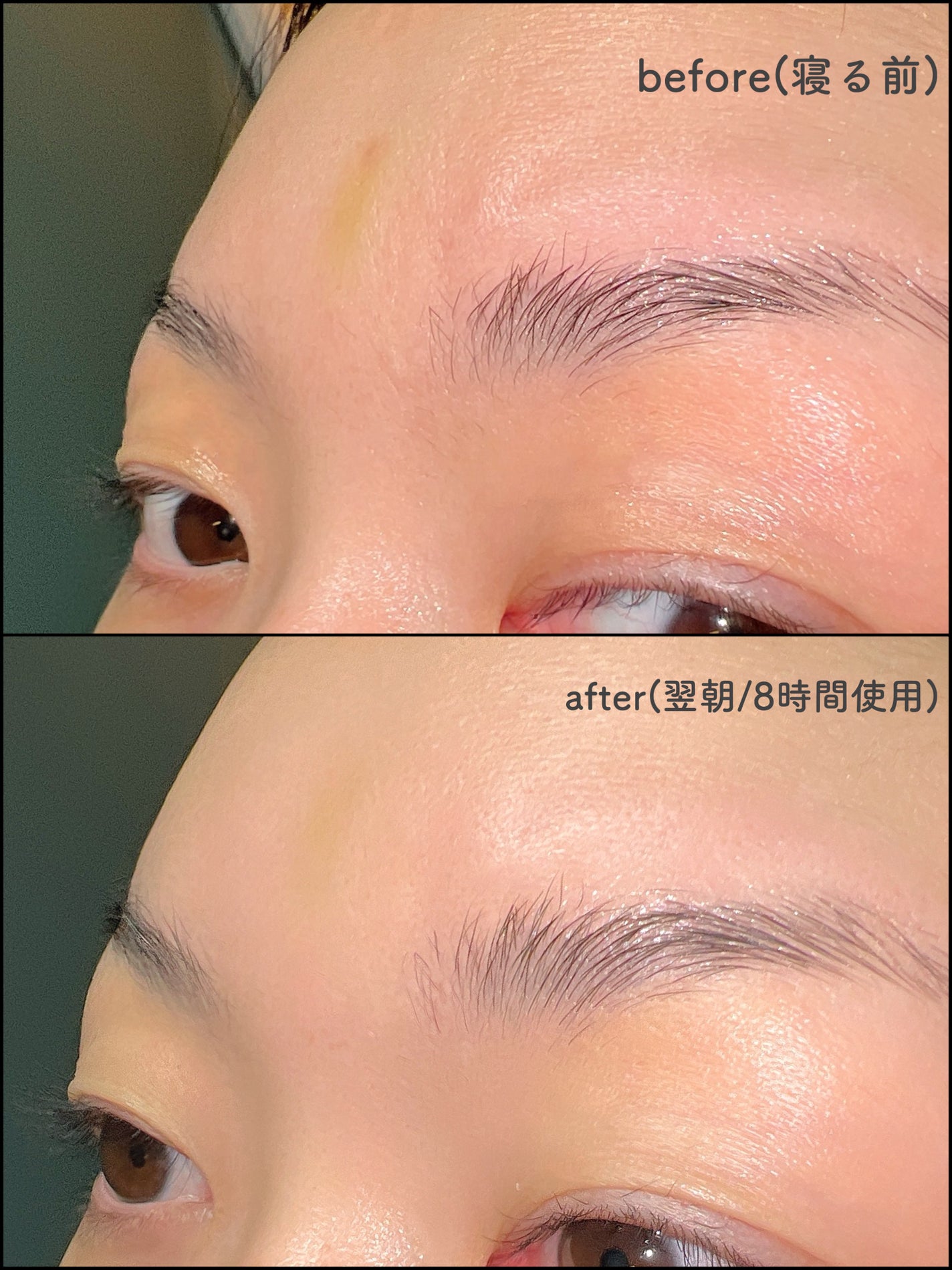 リンクルリペアしわパッチ/MARSHIQUE/その他スキンケアを使ったクチコミ(5枚目)