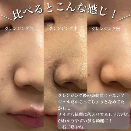 ブラックジェルクレンジング/.akaran/クレンジングジェルを使ったクチコミ(7枚目)