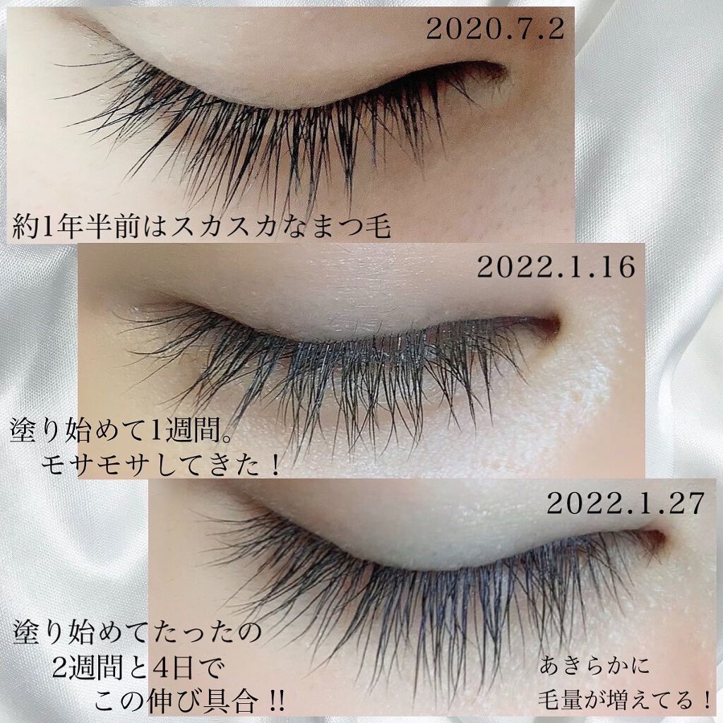 MIRO on LIPS 「【まつ毛育毛の経過!!】かなりの効果で驚きです🥺✨毛量があきら..」(2枚目)