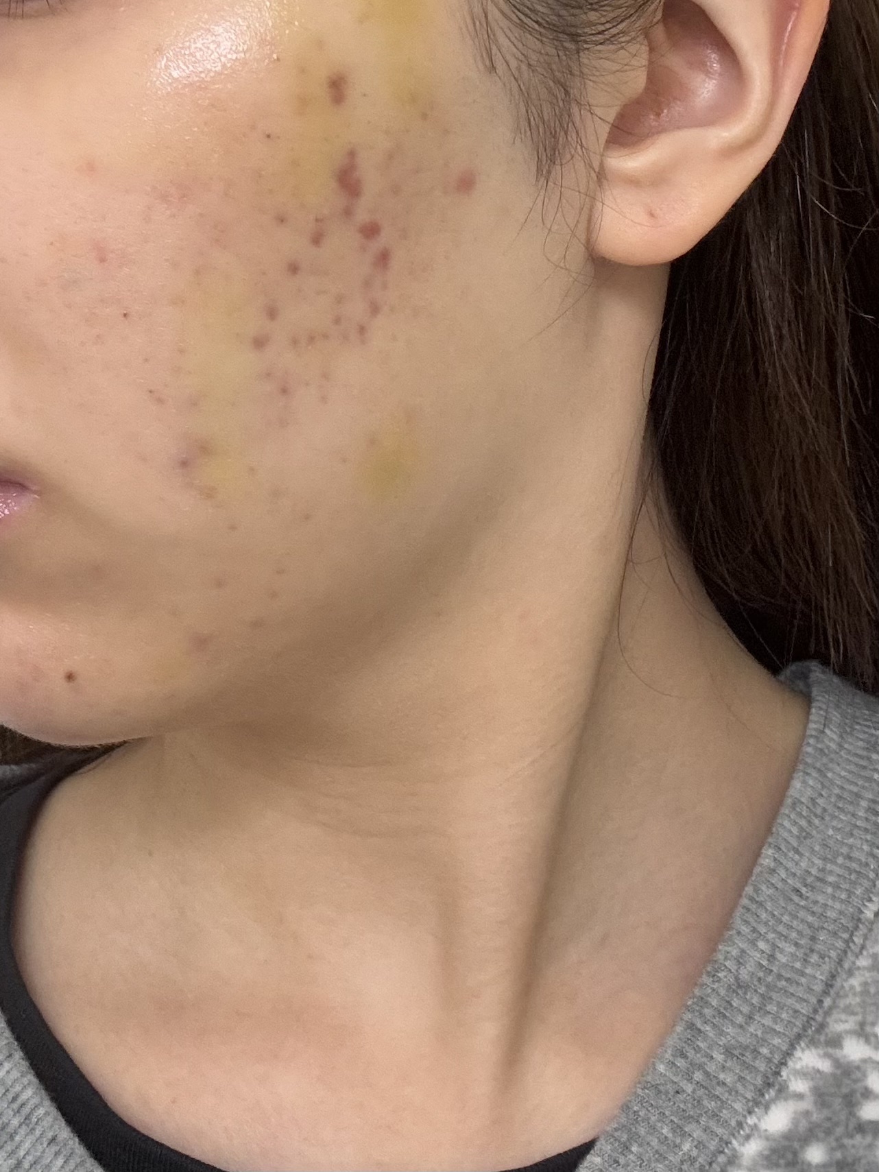 浸透湿潤セラミド１０％★ナノエマルジョン/TOUT VERT/乳液を使ったクチコミ（2枚目）