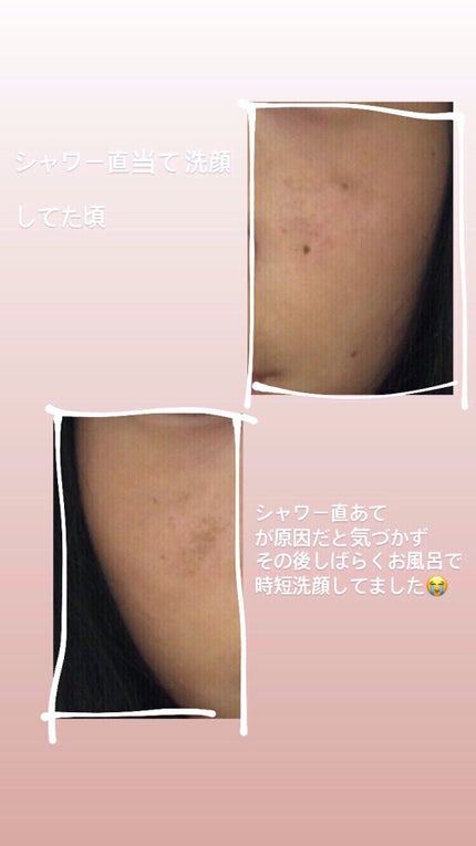 薬用保湿化粧水/オードムーゲ/化粧水を使ったクチコミ(3枚目)
