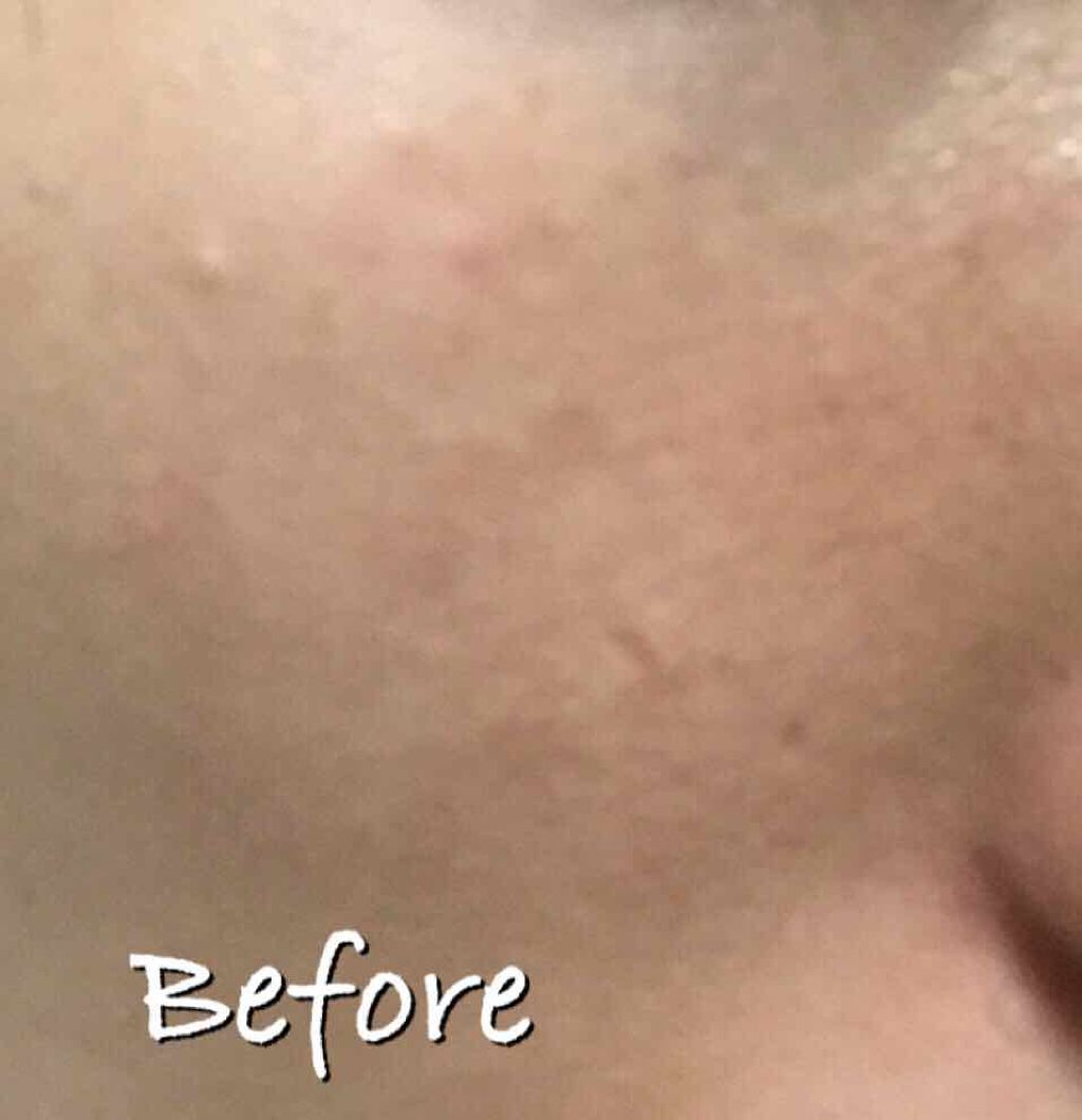 肌をうるおす保湿美容液/肌をうるおす保湿スキンケア/美容液を使ったクチコミ（2枚目）