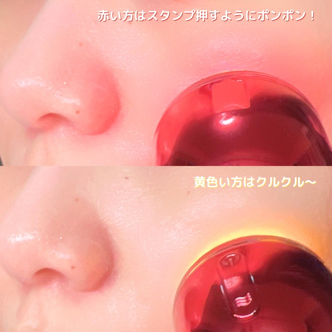 シューマジゴールド糸リフティングクリーム+EMS美顔器/MEDITHERAPY/フェイスクリームを使ったクチコミ(4枚目)