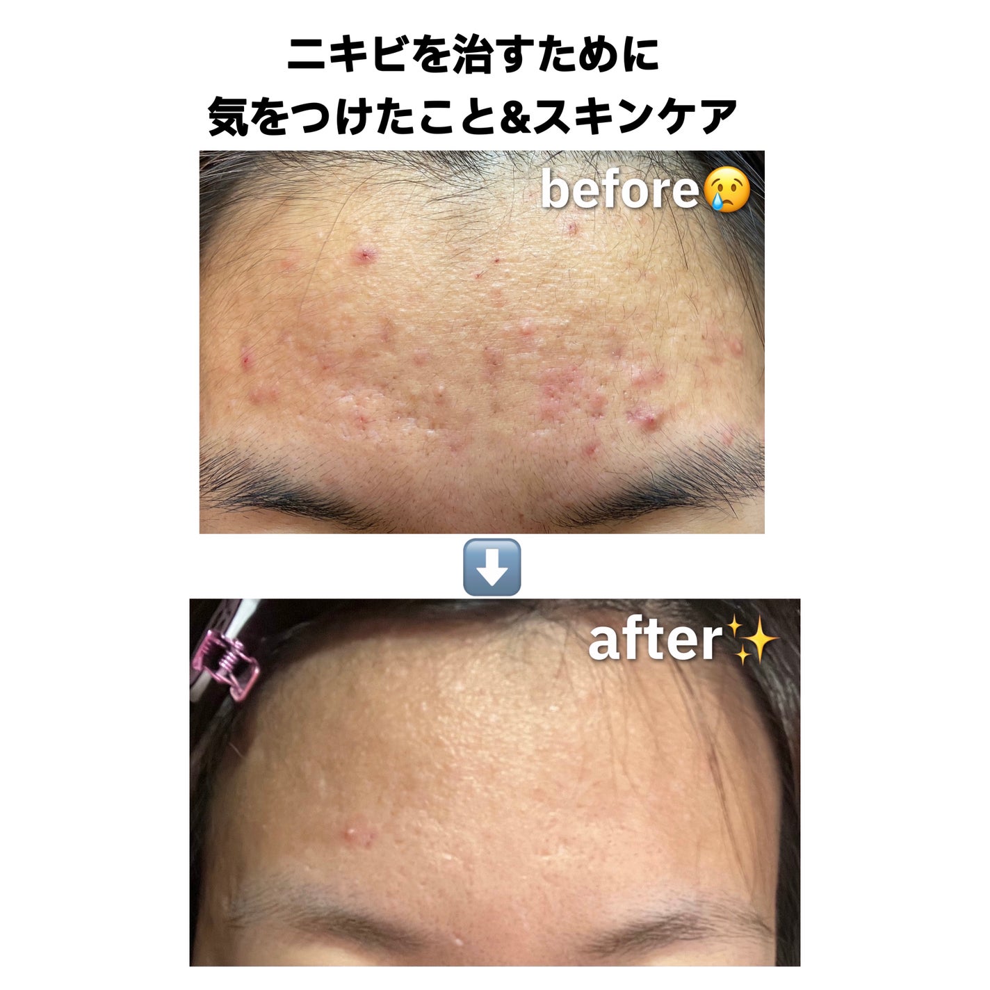 ティーツリーケア ソリューション エッセンシャルマスクEX/MEDIHEAL/シートマスク・パックを使ったクチコミ(1枚目)