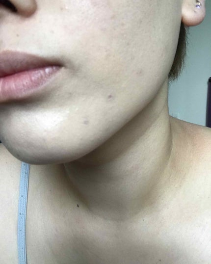 メディキューブレッドクッション/MEDICUBE/クッションファンデーションを使ったクチコミ(4枚目)