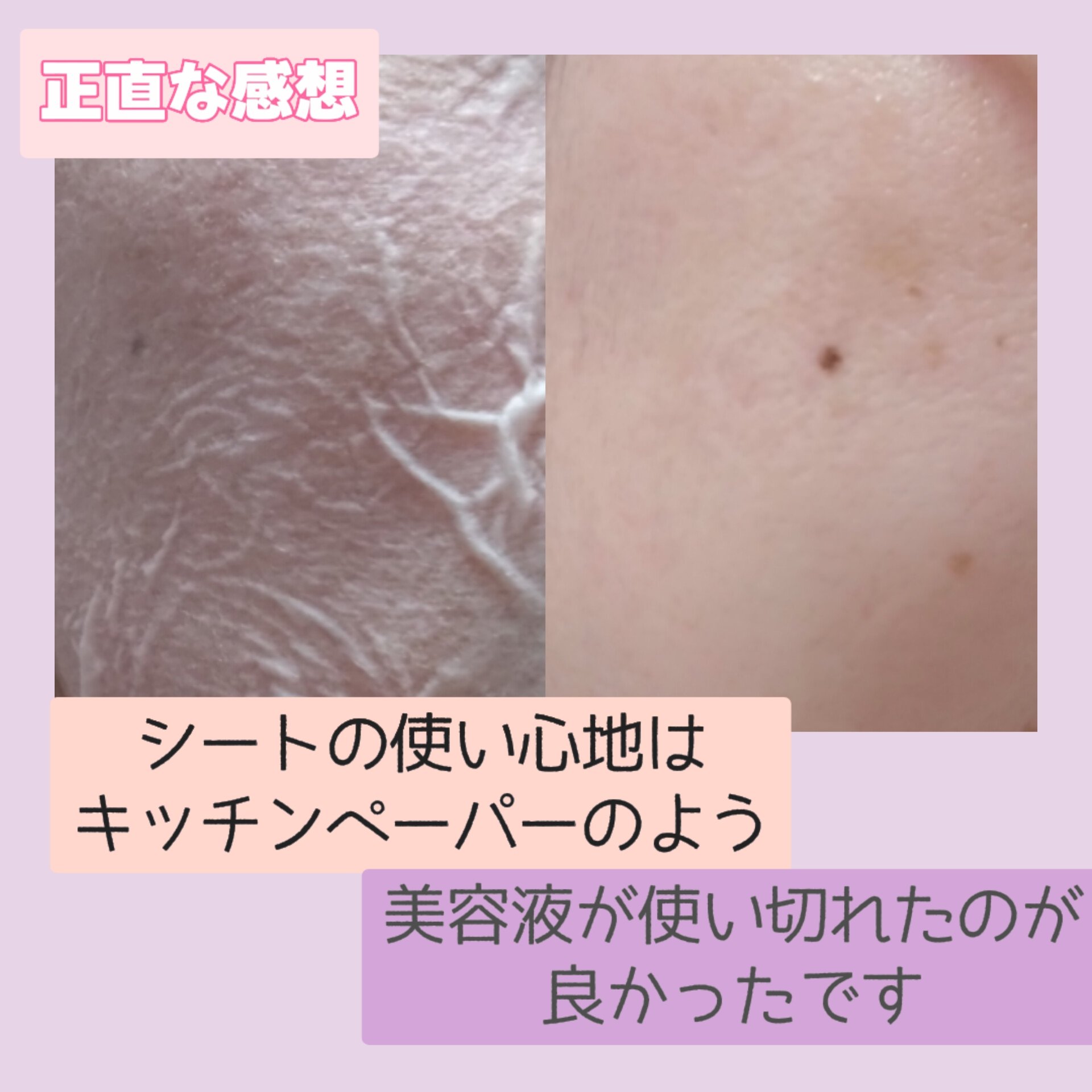 毛穴小町 白桃香るマスク/クリアターン/シートマスク・パックを使ったクチコミ（3枚目）