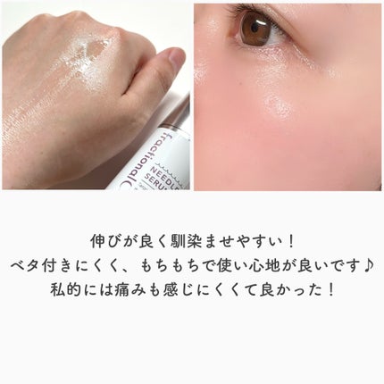 ニードルセラムA/fractionalCC/美容液を使ったクチコミ(5枚目)