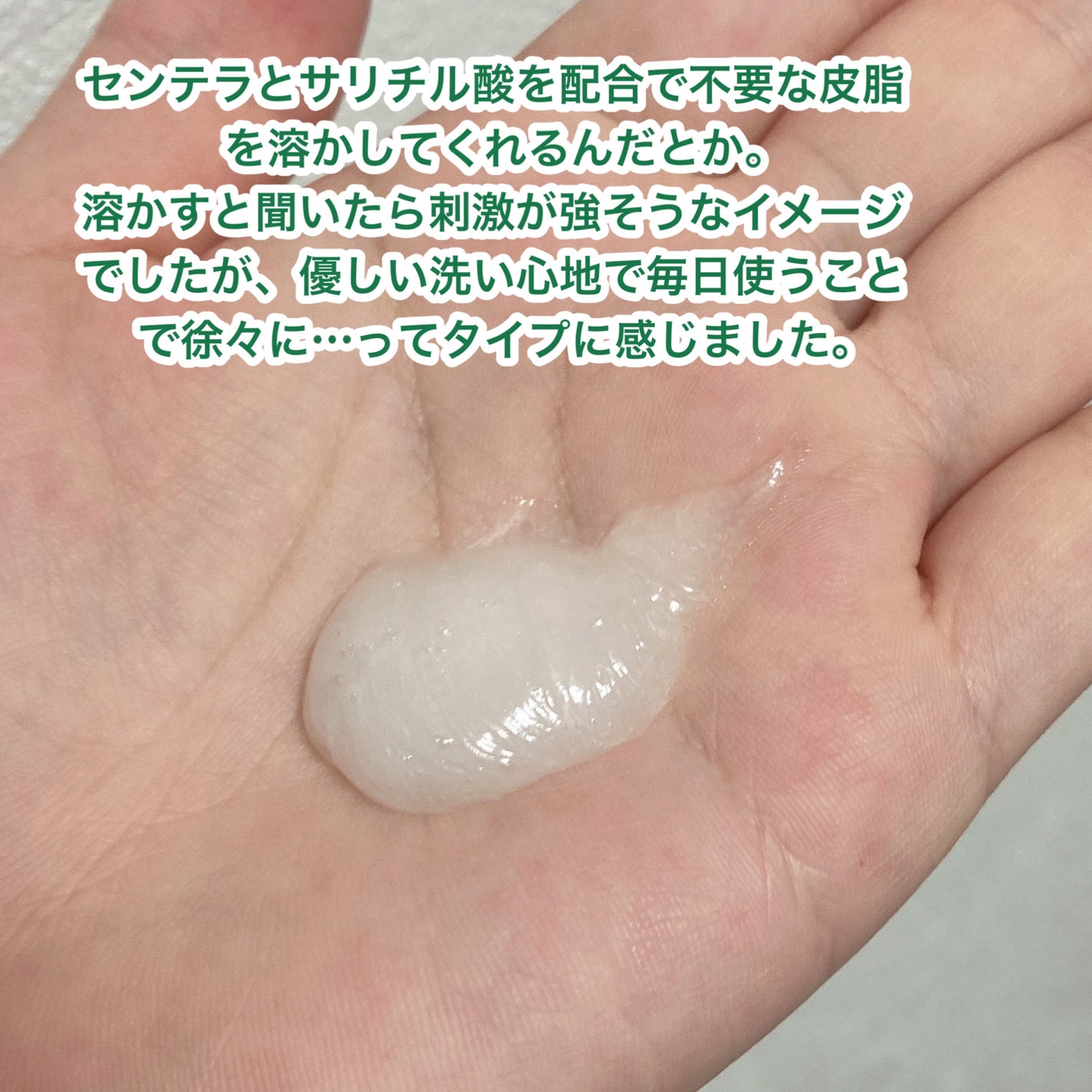 アンダーポアフォームクレンザー/P.CALM/洗顔フォームを使ったクチコミ(2枚目)