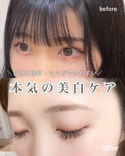 ゴールドC ビタミンC/CALIFORNIA GOLD NUTRITION/健康サプリメントを使ったクチコミ(1枚目)
