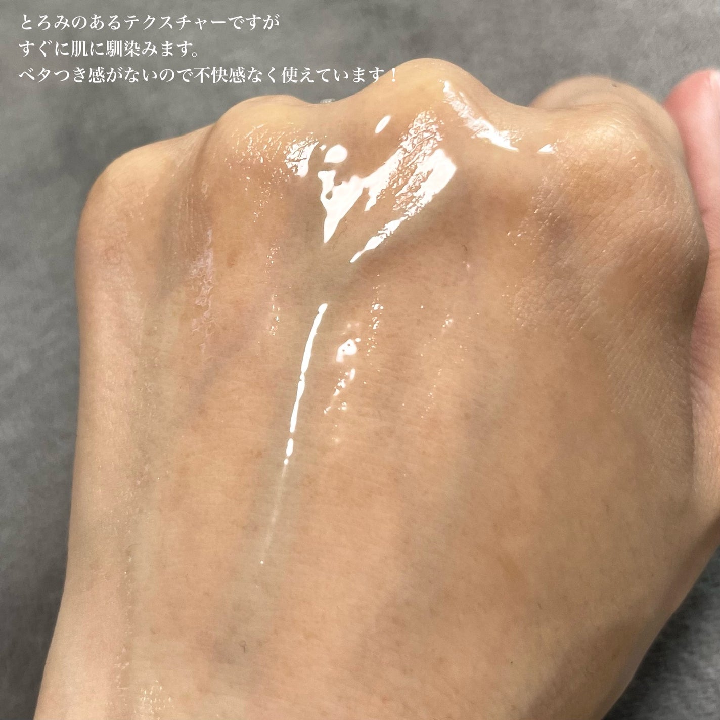 VIO TREATMENT LOTION/iroha INTIMATE CARE/デリケートゾーンケアを使ったクチコミ(3枚目)