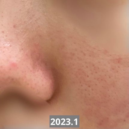 しろいるか on LIPS 「突然ですが、助けてください‼️前回の投稿から1年ほどが経ってし..」(4枚目)