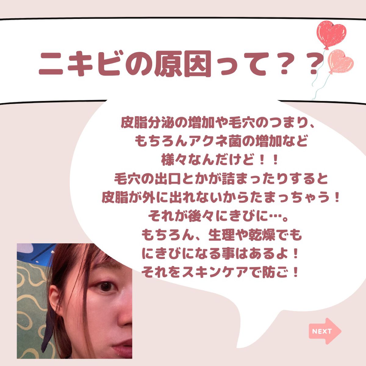 ロゼット洗顔パスタ アクネクリア/ロゼット/洗顔フォームを使ったクチコミ（3枚目）