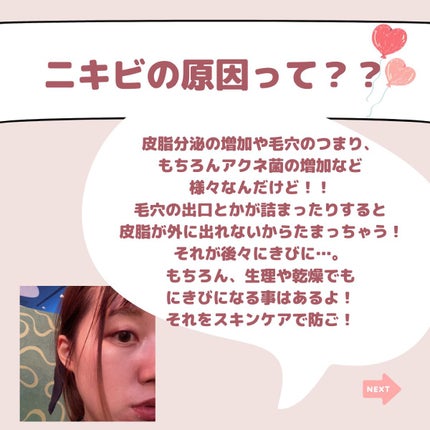 ロゼット洗顔パスタ アクネクリア/ロゼット/洗顔フォームを使ったクチコミ(3枚目)