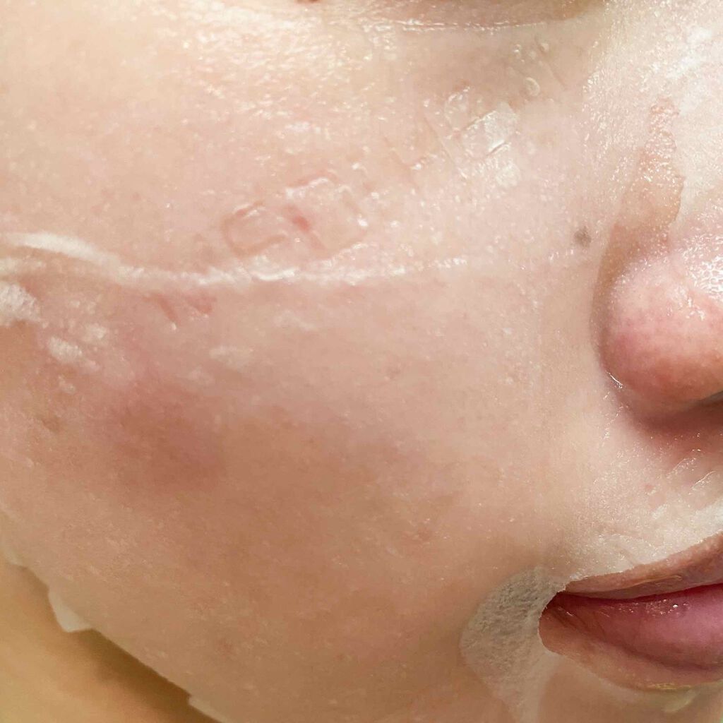 ティーツリーケア ソリューション エッセンシャルマスクEX/MEDIHEAL/シートマスク・パックを使ったクチコミ（3枚目）