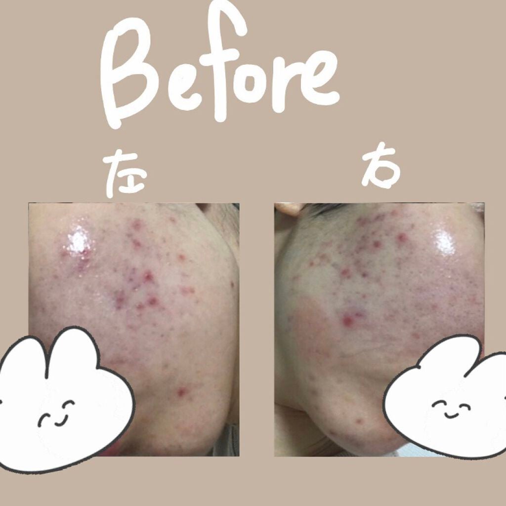 ロゼットゴマージュ モイスト/ロゼット/ピーリングを使ったクチコミ(1枚目)