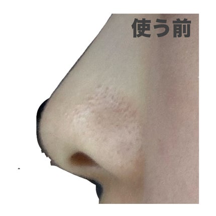 パーフェクトワンフォーカス スムースクレンジングバーム ディープブラック/PERFECT ONE FOCUS/クレンジングバームを使ったクチコミ(4枚目)