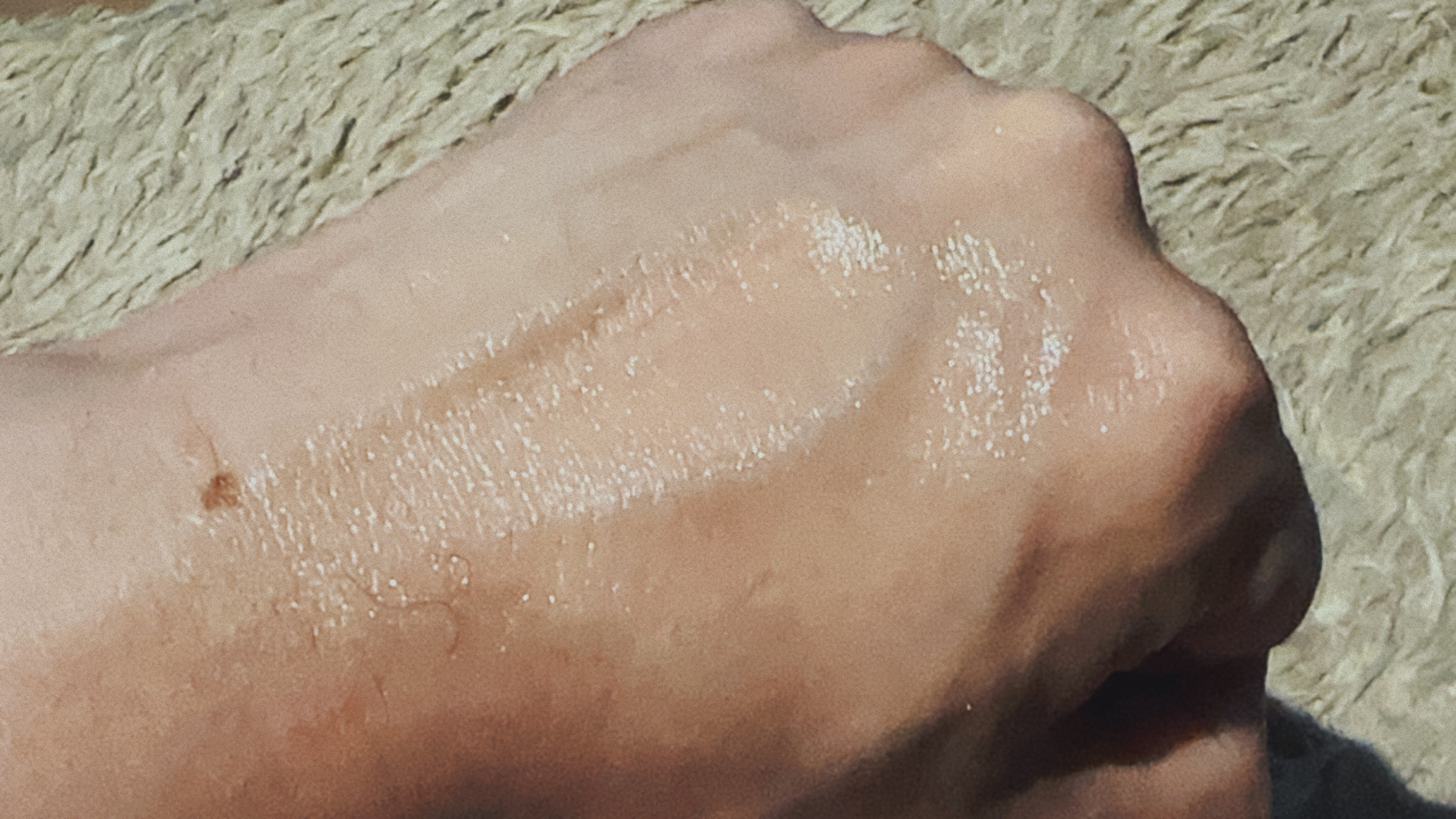 メラケアインテンシブクリーム/Genabelle/フェイスクリームを使ったクチコミ（2枚目）