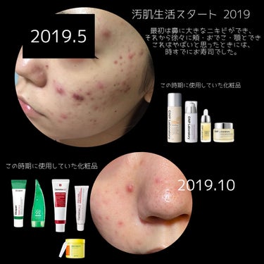 ネイチャーコンク 薬用クリアローション/ネイチャーコンク/拭き取り化粧水を使ったクチコミ（2枚目）