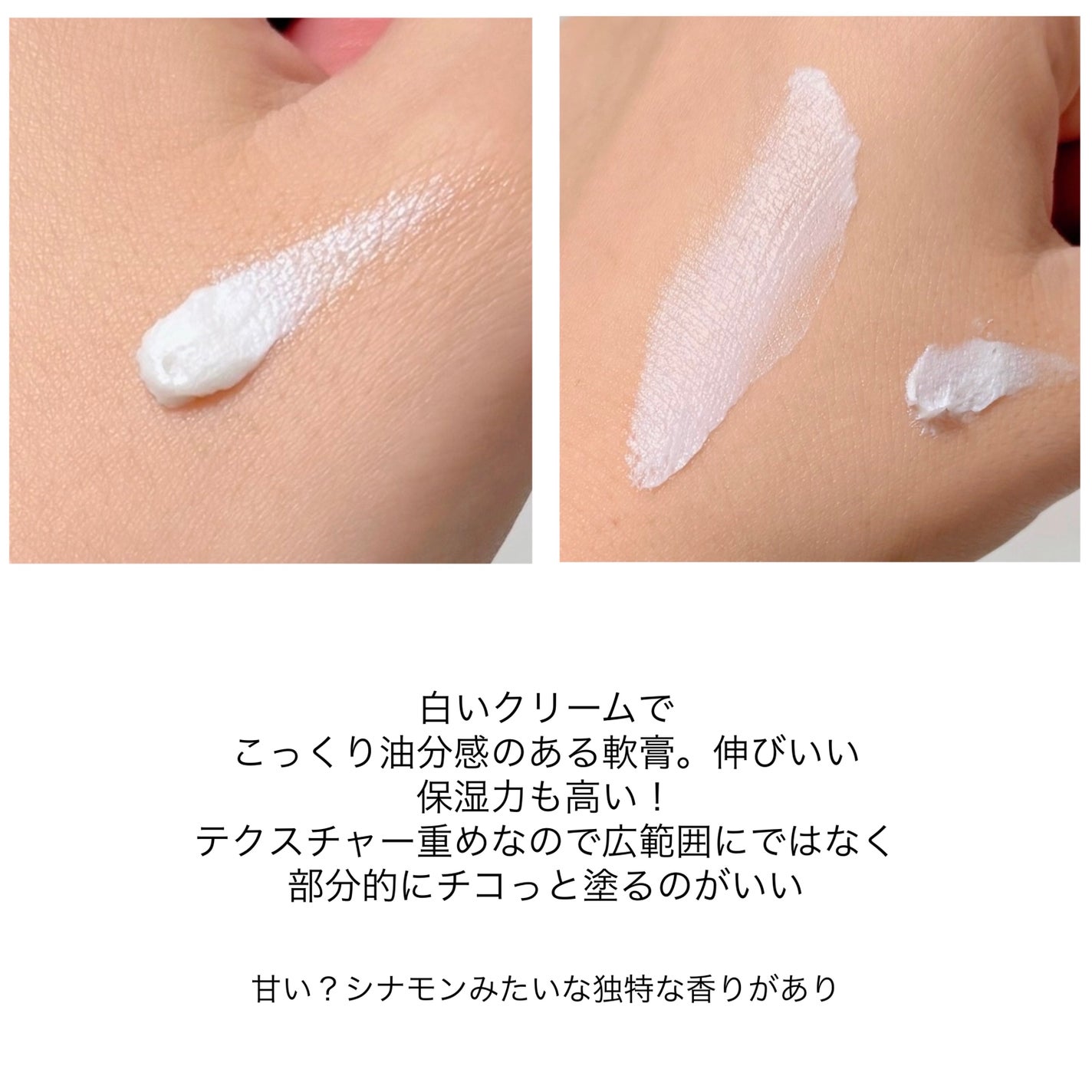 オロナインH軟膏 (医薬品)/オロナイン/その他を使ったクチコミ(2枚目)