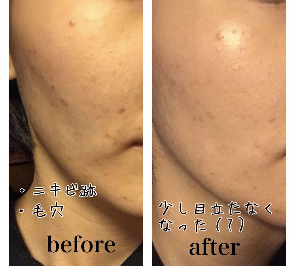 リアルカバーリキッド（ライトグロウ）/KATE/リキッドファンデーションを使ったクチコミ（3枚目）