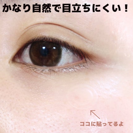 キャッチミーパッチ/CATCH ME PATCH/にきびパッチを使ったクチコミ(6枚目)