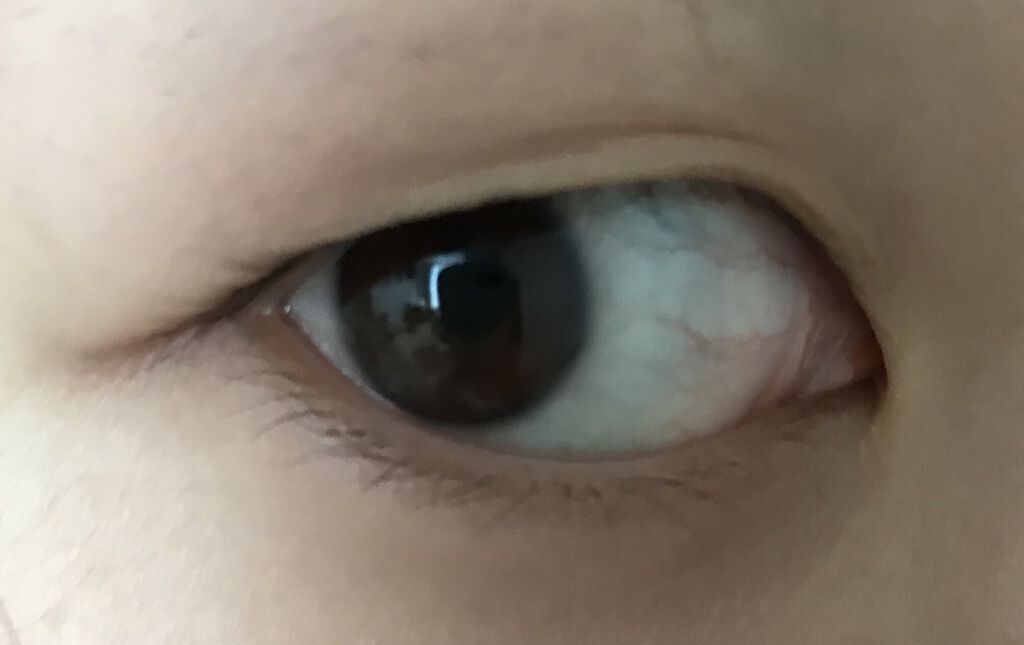 オリシキ アイリッドスキンフィルム		/D-UP/二重まぶた用アイテムを使ったクチコミ（2枚目）